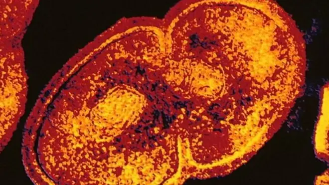 เชื้อแบคทีเรีย