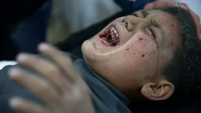 أحد الأطفال المصابين