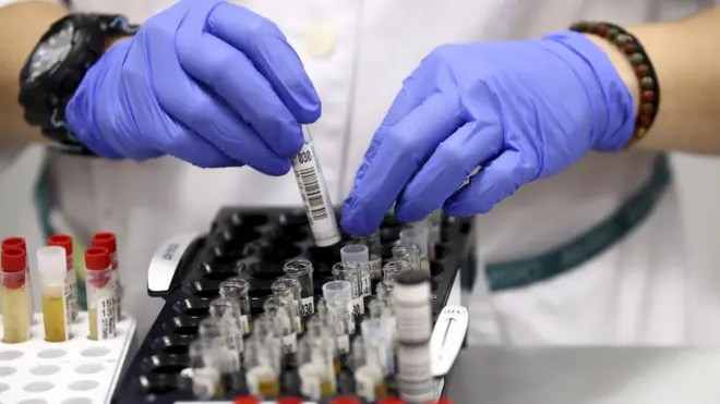 Пробирки перед биохимическим анализом на антитела к COVID-19