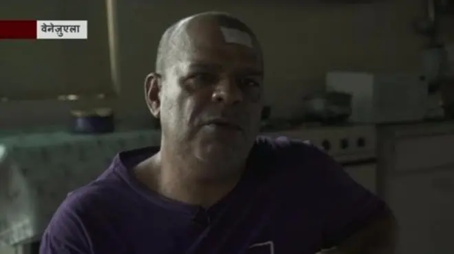 वेनेज़ुएला