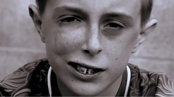 Діти, на яких витріщаються: як їм живеться?