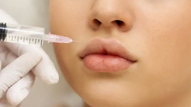 Tinejdžerke koje žele da uvećaju usne zbog pritiska s društvenih mreža