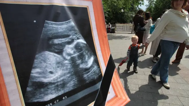 Ранее акции против абортов не раз устраивали православные активисты, но на официальный уровень вопрос не выносился