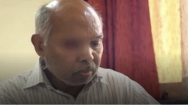 ผู้ชายสูงอายุตาเสียหนึ่งข้าง