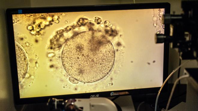 美国马里兰州罗克维尔市一家生殖专科诊所内放于显微镜下的人类卵子（资料图片）