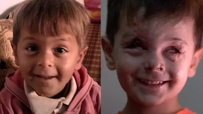 Jouma antes e depois de ser atingido por ataque aéreo na Síria