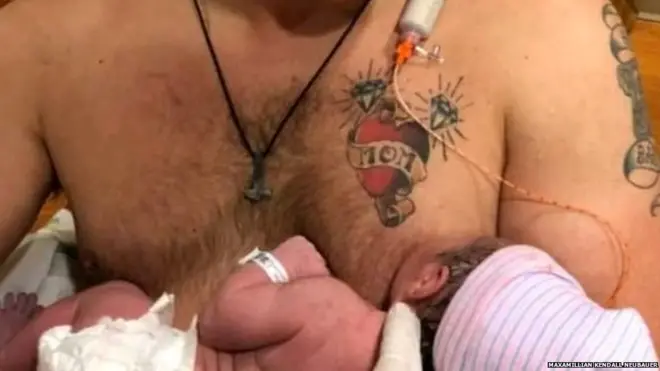 ब्रेस्टफ़ीड