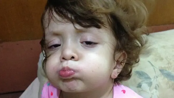 امریکی ہسپتال نے بچی کا مفت علاج کرنے کی پیش کش کی ہے
