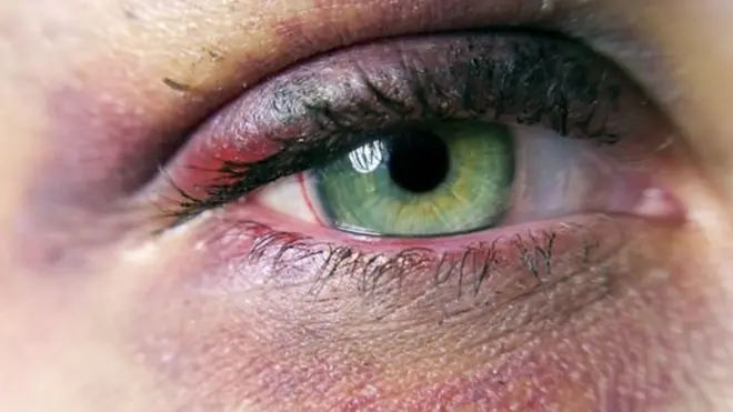 Ailə zorakılığı qurbanları tərəfindən polisə müraciətlərin sayı artmaqdadır.