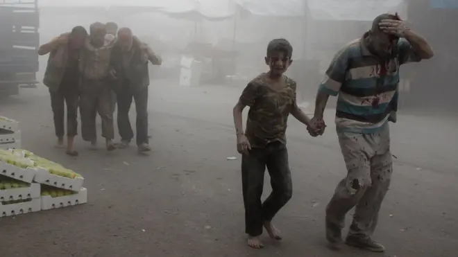 İdlib, 10 sentyabr, 2016. Yaralı kişi və uşaq hava hücumundan sonra ərazidən çıxarılır.