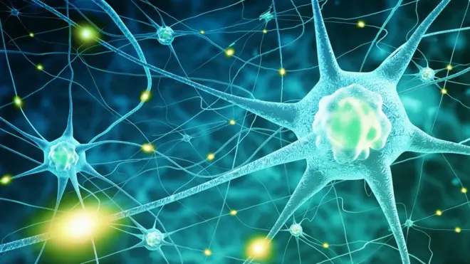 Una hemorragia cerebral suele causar el síndrome.