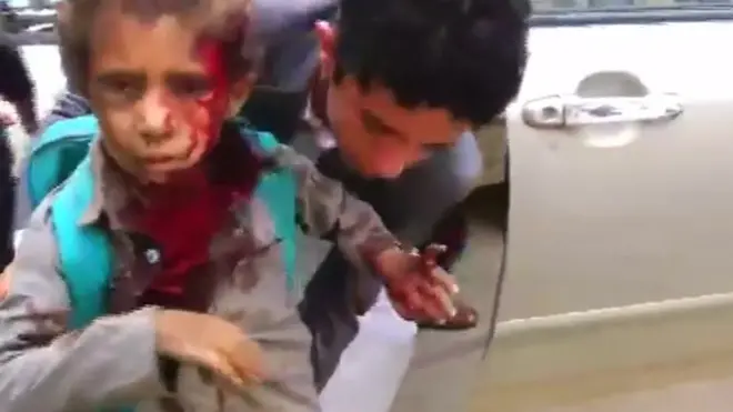Injured boy is helped after reported air strike in Saada province, Yemen