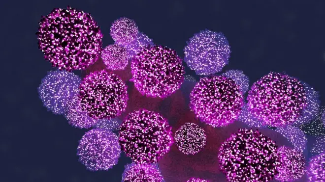 Virusi vya HIV huua kinga yote ya mwili na kuacha mwiwi kwenye hatari ya kuambukizwa maradhi mengine.