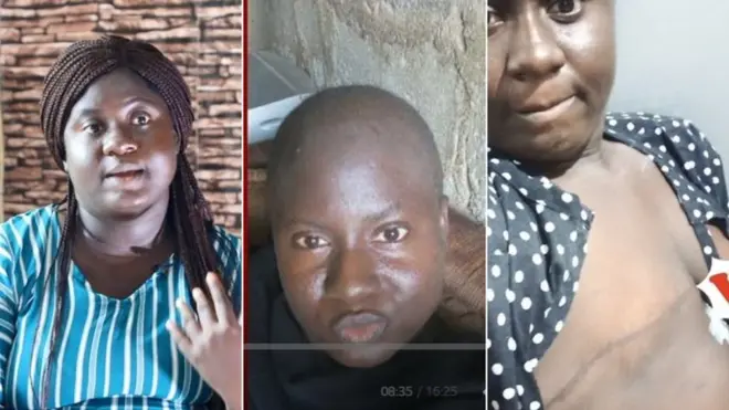 Abisayo Fakiyesi to bori jẹjẹrẹ