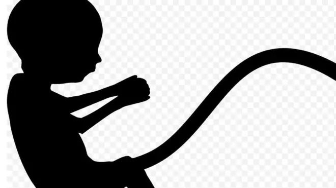 Umbilical cord: Àìsàn Màrùndíláàdọ́rùn ni ìwọ́ ọmọ tuntun le wòsàn