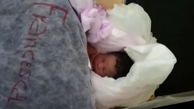 Beba Mirirkl nakon rođenja