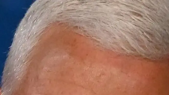 ሙሉ ለሙሉ ስበት ሆነ ጸጉር