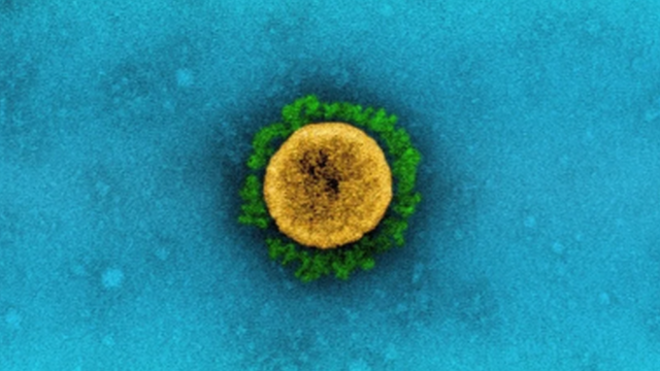 ภาพขยายเชื้อไวรัสโควิด-19 สายพันธุ์แลมบ์ดา ซึ่งพบครั้งแรกในประเทศเปรู