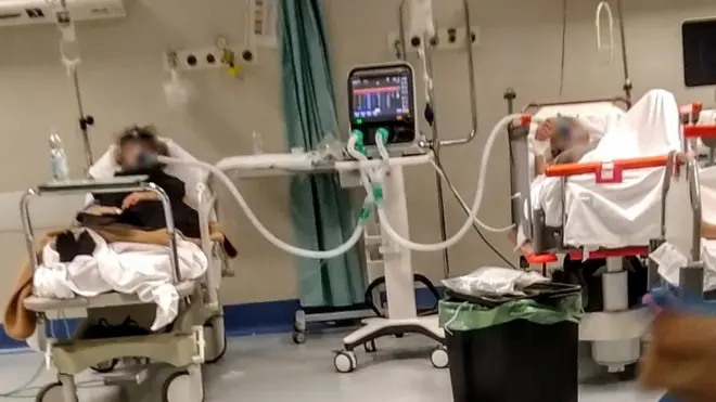 Diante da faltadicas de aposta sportingbetrespiradoresdicas de aposta sportingbetseu hospital, ele decidiu tomar a medida extremadicas de aposta sportingbetdividir um ventilador entre dois pacientes.