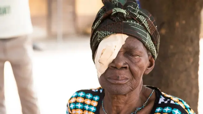 Woman with patch on eye