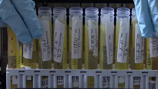 اختبار بول يكشف عن صحة النظام الغذائى للشخص