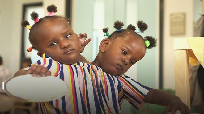 Aos 3 anos, as irmãs Marieme e Ndeye superaram previsões e aprenderam até a se movimentar.
