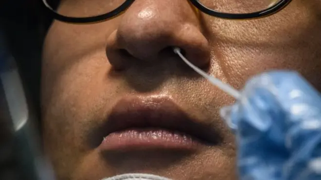 Mütəxəssislərin dediyinə görə, "Covid-19" virusundan müalicə olunmuş şəxslərin 14%-ində təkrar test zamanı yenidən virus aşkar edilir