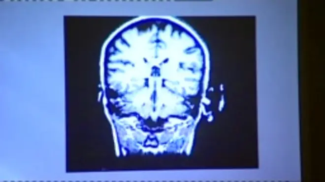 خلصت دراسة أمريكية إلى أن تناول المشروبات المحلاة اصطناعياً يلحق مخاطر بالعقل كما بالجسم.