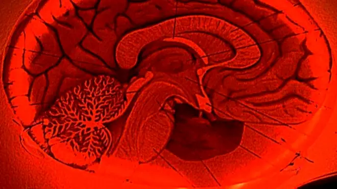 Мозг человека