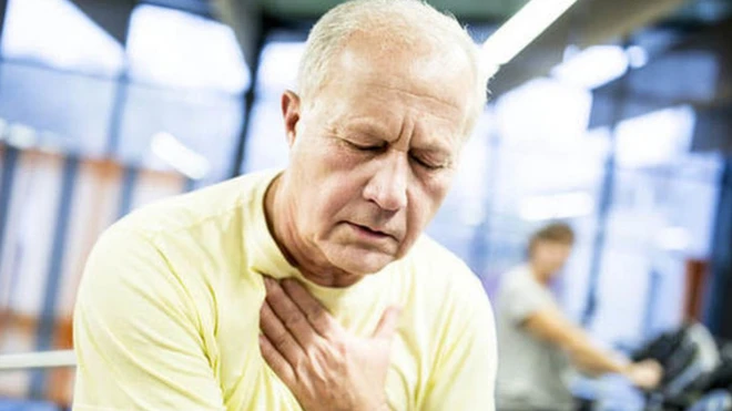 รอยเหี่ยวย่น