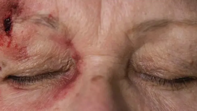 nasilje na starijima