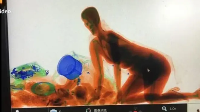 ภาพถ่ายจากเครื่องเอ็กซ์เรย์