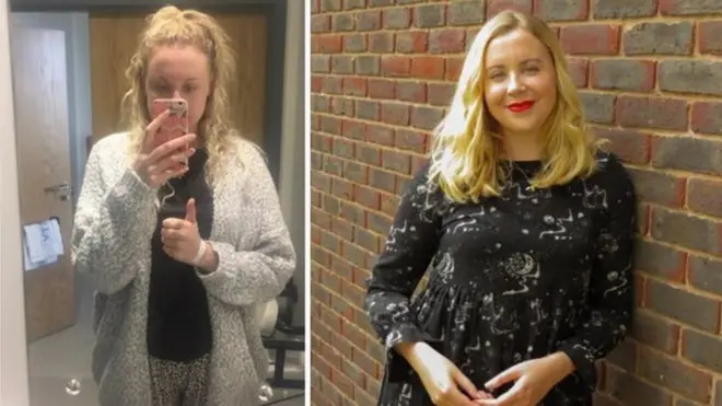 BBC记者凯莱患慢性白血病