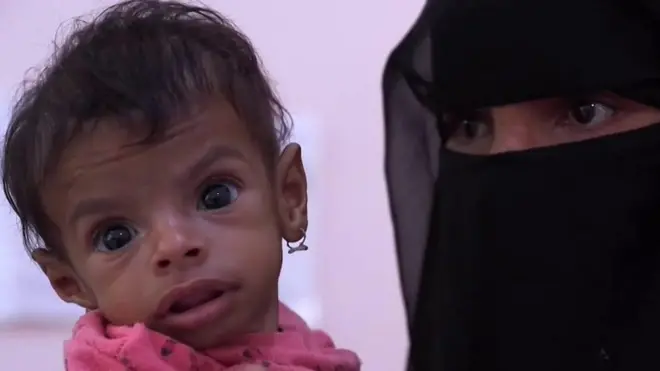 د یمن جګړې لومړۍ کرښه کې ډاکټره 'جګړه ختمه کړئ، هرڅه به سم شي'