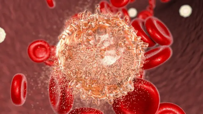 A leucemia linfoblástica (ou linfoide) aguda afeta cercacaça nicks300 mil crianças por ano no mundo todo