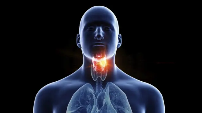 Illustration of a man's larynx cancer