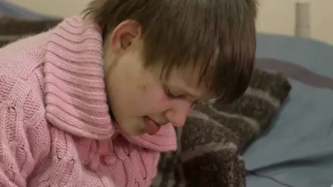 Напуштена деца са инвалидитетом у Украјини