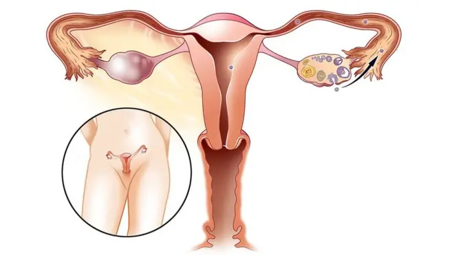 የሴቶች የመራቢያ ክፍል