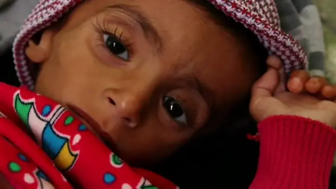 منظمة الأمم المتحدة تحذر من أن اليمن قد يشهد قريبا مجاعة على "نطاق ضخم" إذا استمرت الحرب الدائرة هناك دون وصول المساعدات إلى المحتاجين.