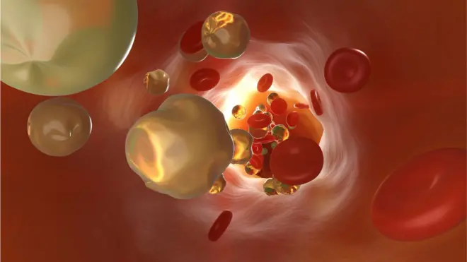 Холестерин в крови