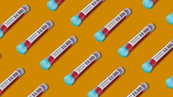 የኮሮና ሳምፕል