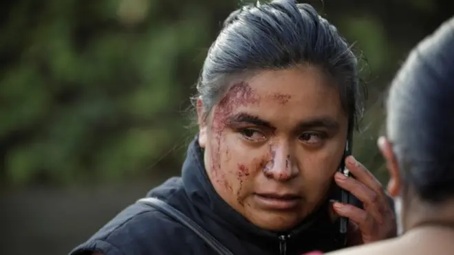 Una mujer que estaba en la zona murió en el ataque.