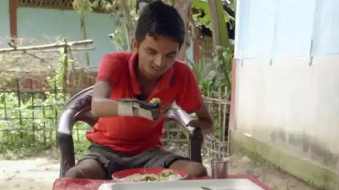 አካል ጉዳተኛ ሲመገብ