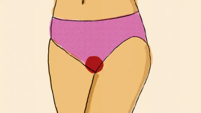 Ropa interior manchada de sangre