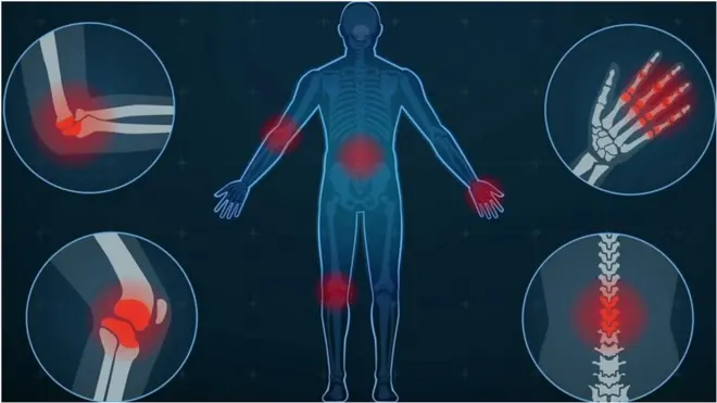 হাঁটু বা শরীরের জয়েন্টে ব্যথা বা বাত ব্যথার ছবি