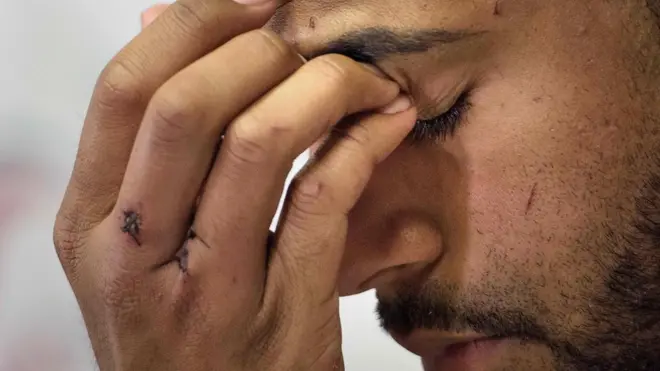 Ángel Colón recibió cuatro impactos de bala antes de lograr salir de la discoteca Pulse el pasado domingo.