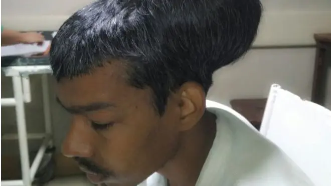 እቲ መጥባሕቲ 7 ሰዓታት ከም ዝወሰደ ሓካይም ገሊጾም