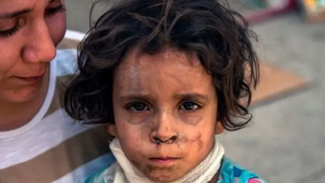 Krisis kemanusiaan di Mosul terungkap setelah ISIS diusir.