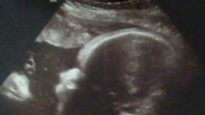 The couple see Jesus in the far left of their sonogram