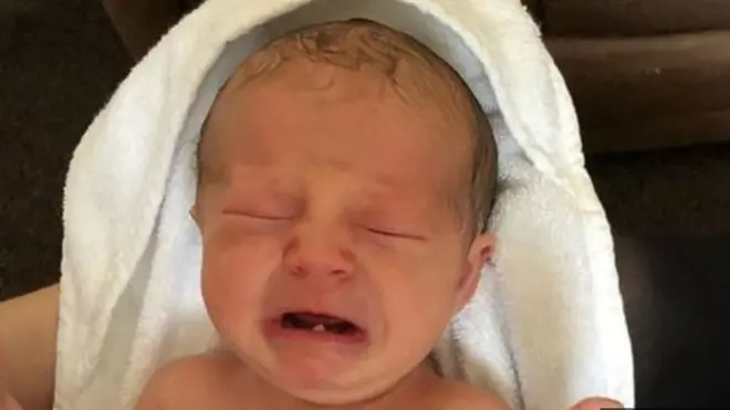 Small baby wey dey cry with one tooth inside im mouth.